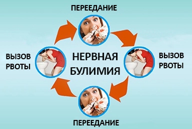 Лечение булимии в Ломоносове